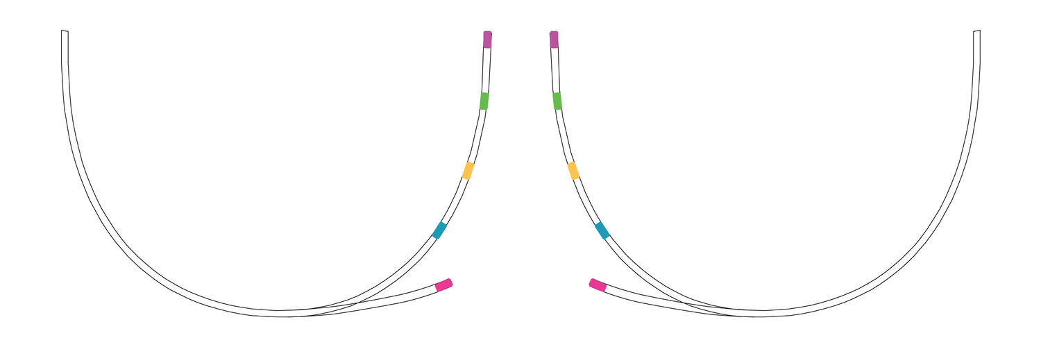 Tout ce qu'il faut savoir sur les armatures